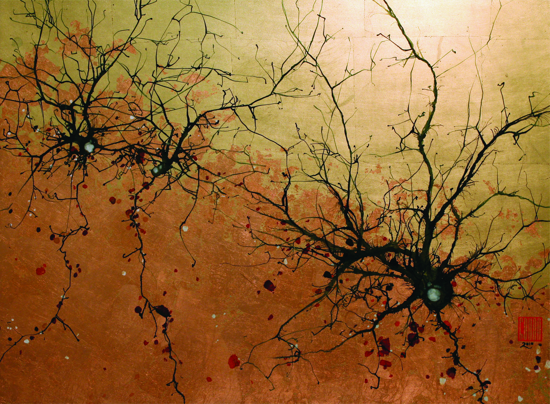 Purkinje Neurons